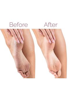 Râpe Électrique Rechargeable Pour Pieds